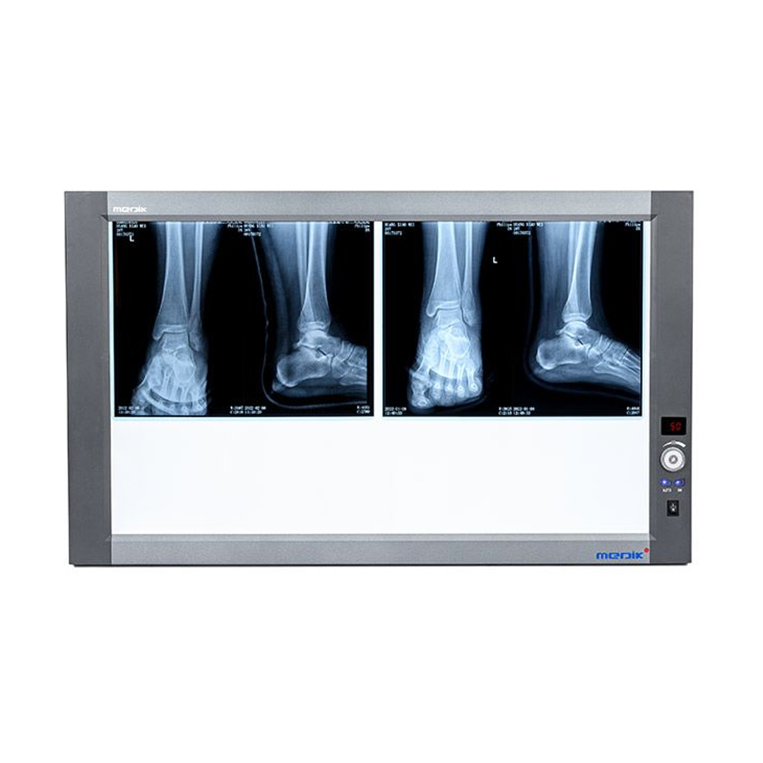 X-Ray Viewer available in online  pharmacy qatar, doha 